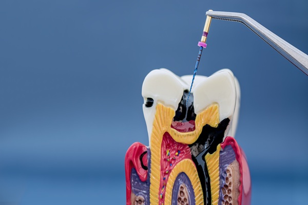 Ways Endodontics Can Improve Your Smile